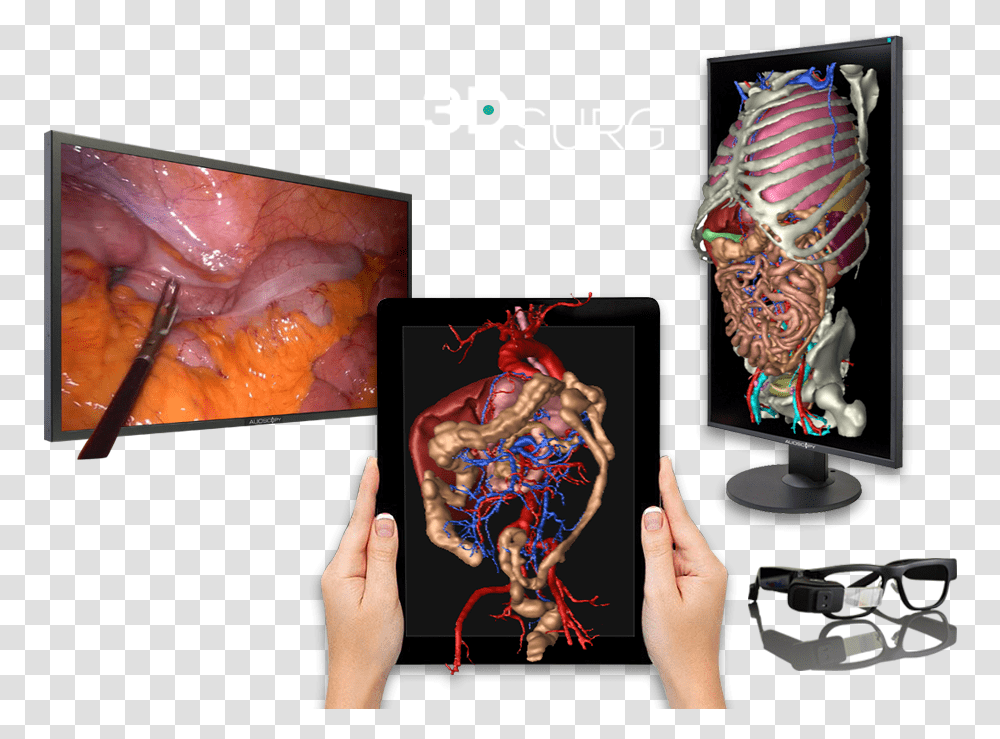 3d Technology Applied To Surgery Graphic Design, Lobster, Person, Jaw, Skin Transparent Png