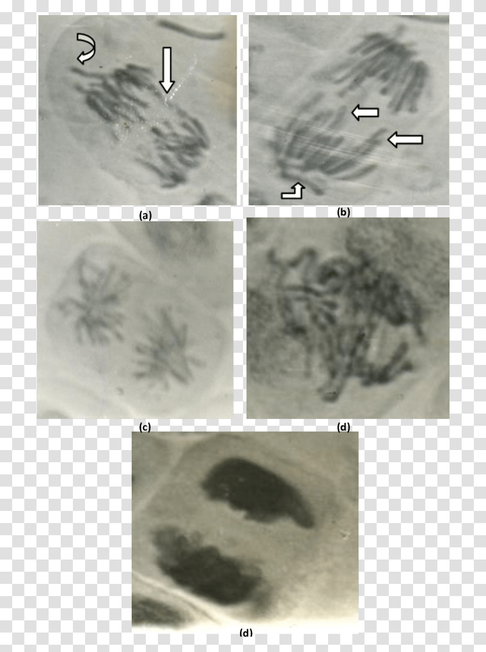 Abnormal Anaphase Cells Showing Medical Imaging, Collage, Poster, Advertisement, Nature Transparent Png