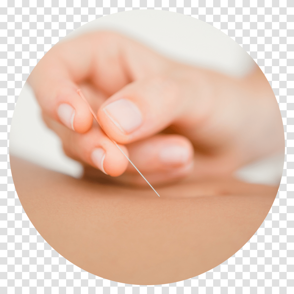 Acupuncture Acupuncture, Hand, Person, Human, Finger Transparent Png