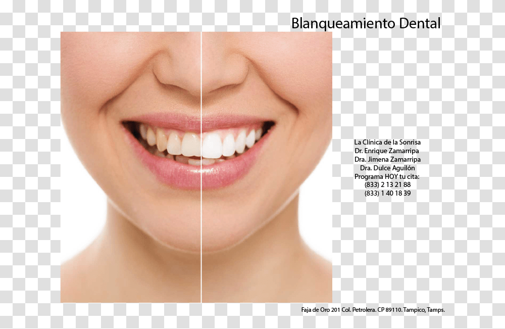 Aesthetic Teeth Restoration, Mouth, Lip, Person, Human Transparent Png