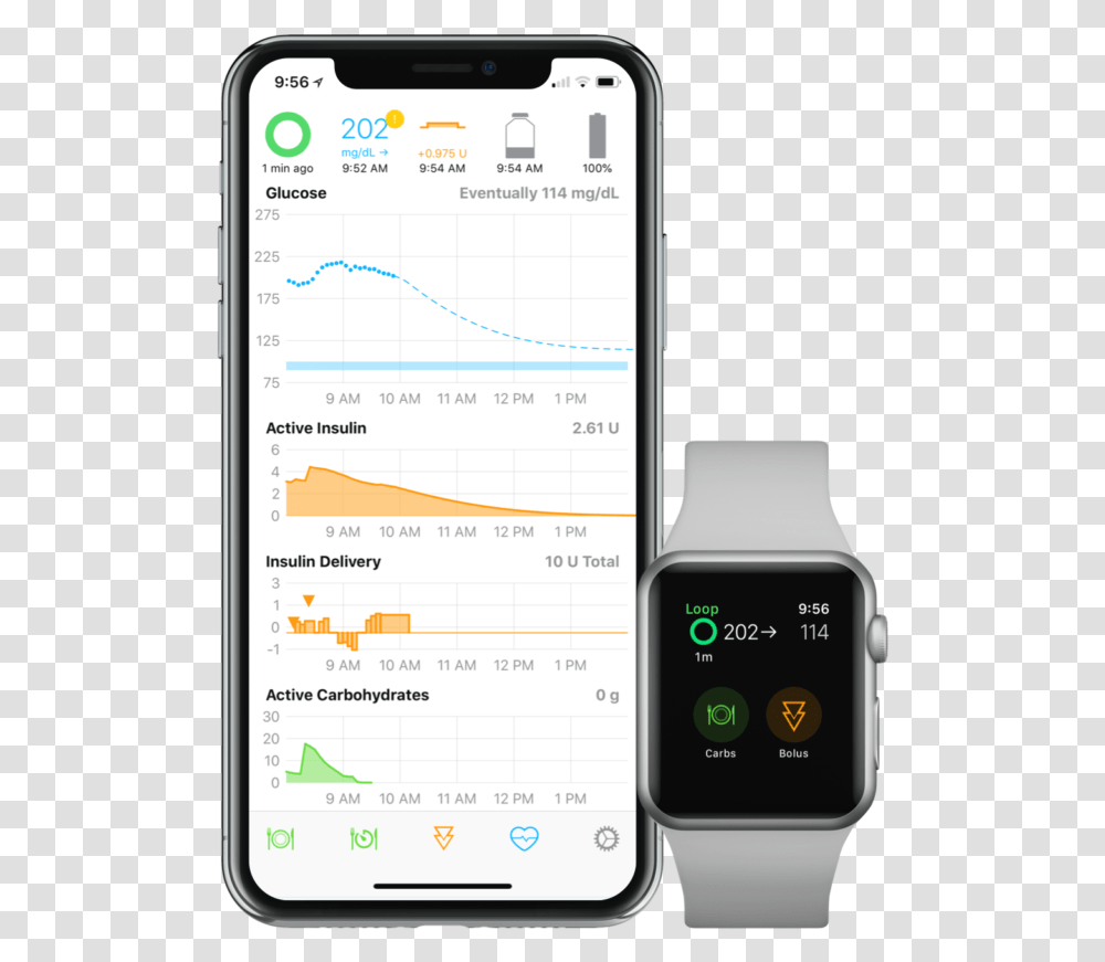 Afib On Apple Watch, Mobile Phone, Electronics, Cell Phone, Wristwatch Transparent Png