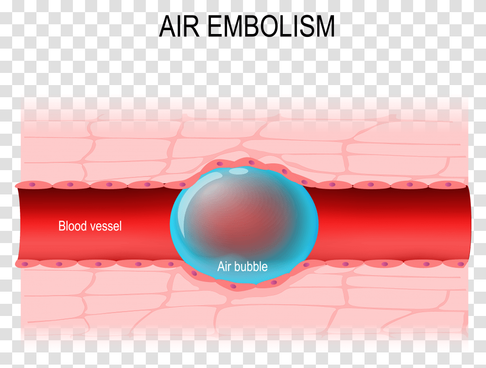 Air Embolism, Sphere, Astronomy Transparent Png