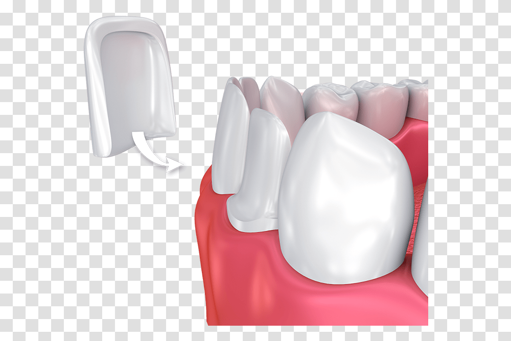 All Tooth Veneers, Apparel, Teeth, Mouth Transparent Png