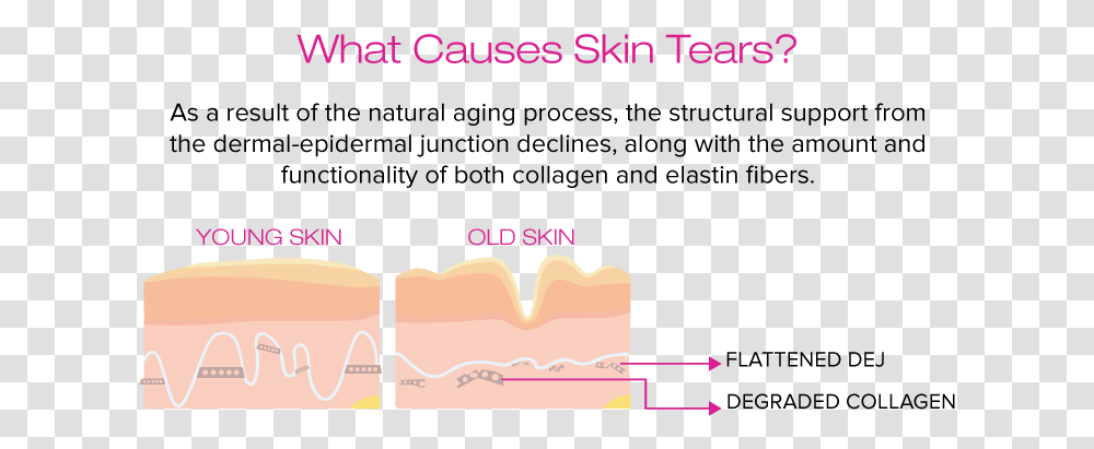Amige What Causes Skin Tears Dermal Epidermal Junction Aging, Paper, Nature, Outdoors Transparent Png