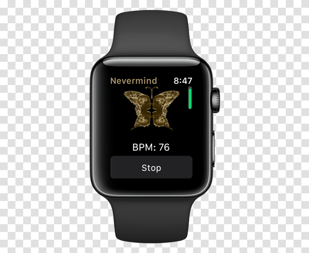 Applewatch Withnm Anylist Apple Watch, Mobile Phone, Electronics, Cell Phone, Wristwatch Transparent Png