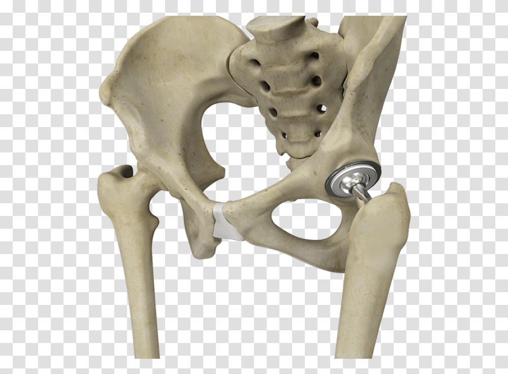 Artificial Hip Joint Total Hip Replacement, Skeleton, Jaw Transparent Png