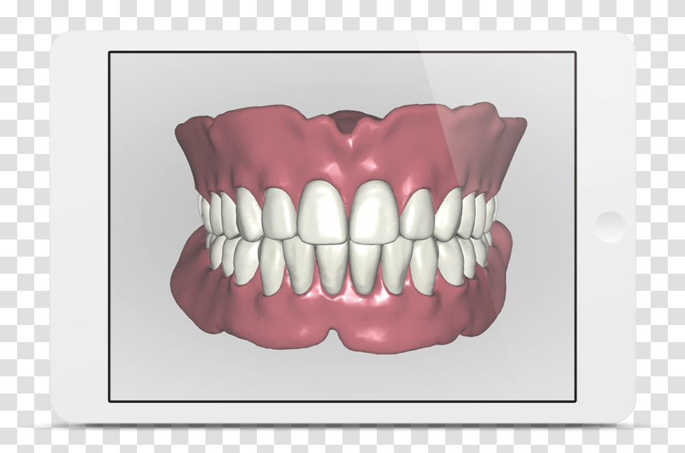Avadent Ipad 3d Gebitsprothese, Jaw, Teeth, Mouth, Lip Transparent Png