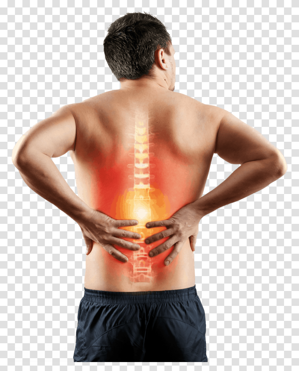 Back Pain Clinic Patient, Person, Human, Arm, Skin Transparent Png