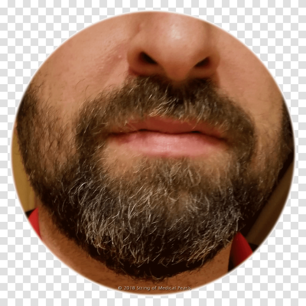 Beard, Face, Person, Human, Mustache Transparent Png