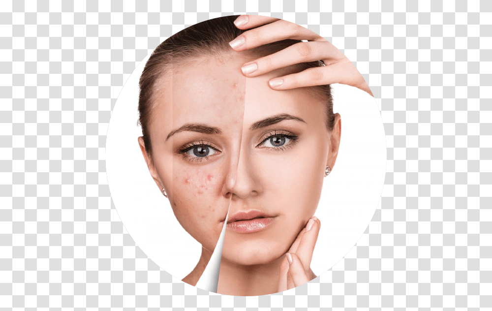 Beauty Face Before And After, Person, Human, Skin, Baby Transparent Png