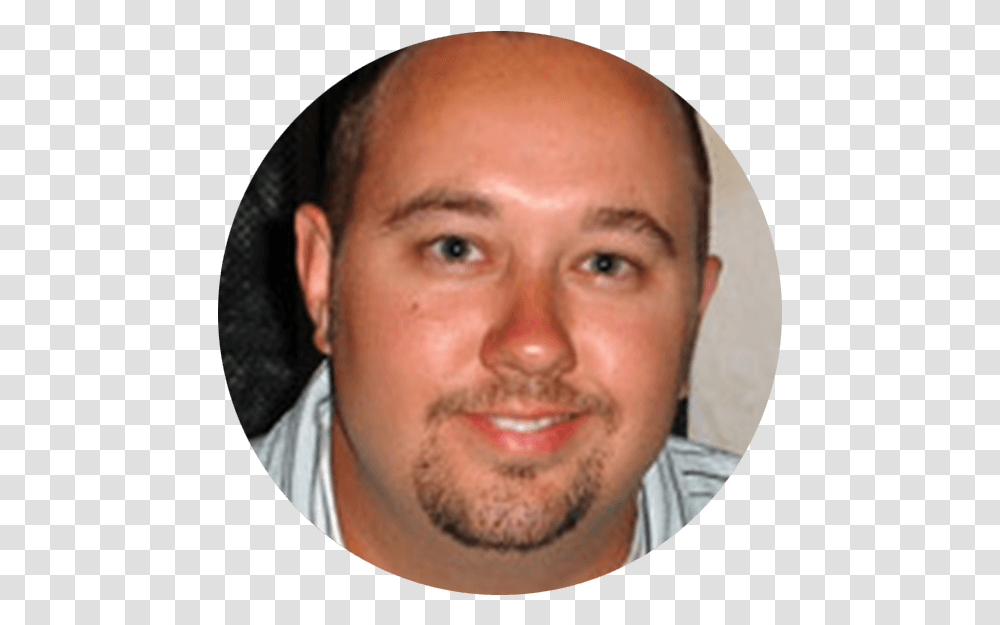 Ben Hair Loss, Face, Person, Human, Head Transparent Png