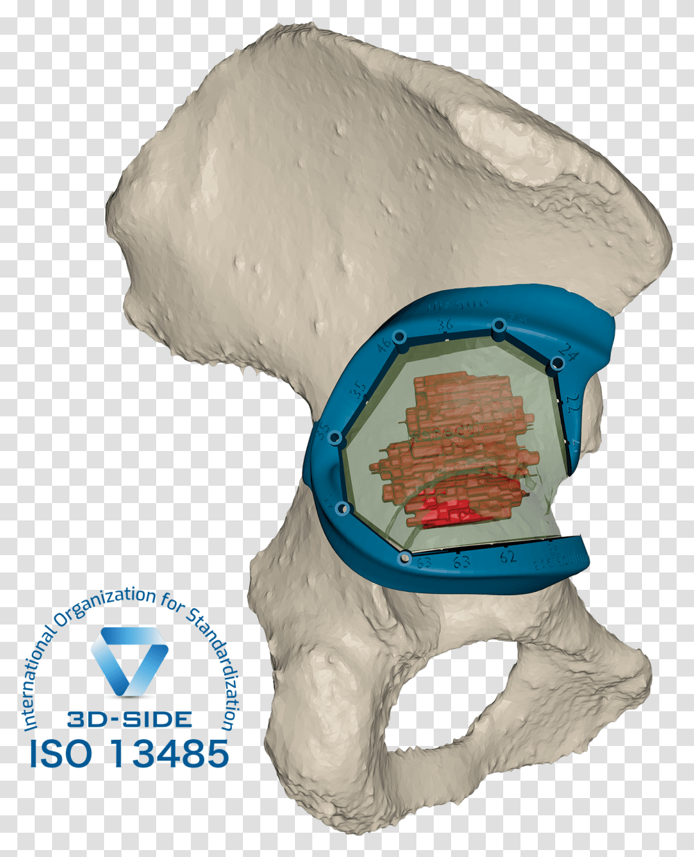 Bone Tumor Resection Illustration, Logo, Trademark, Costume Transparent Png