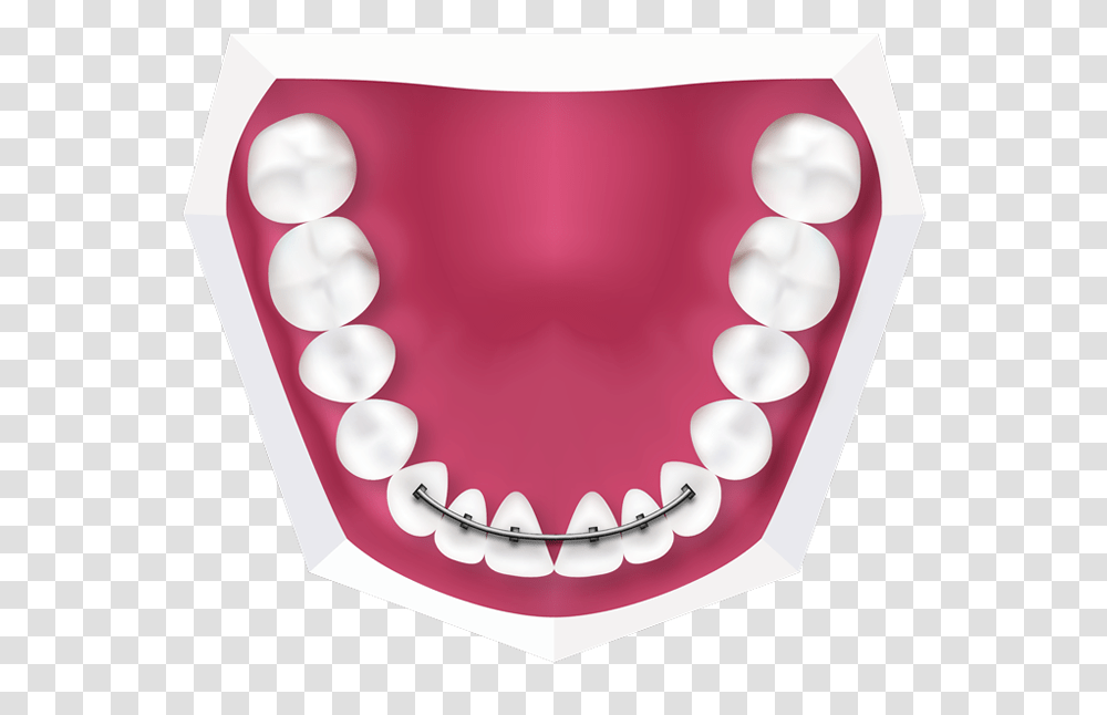 Braces For Kids Richmond London Childrens Orthodontist, Teeth, Mouth, Lip, Jaw Transparent Png