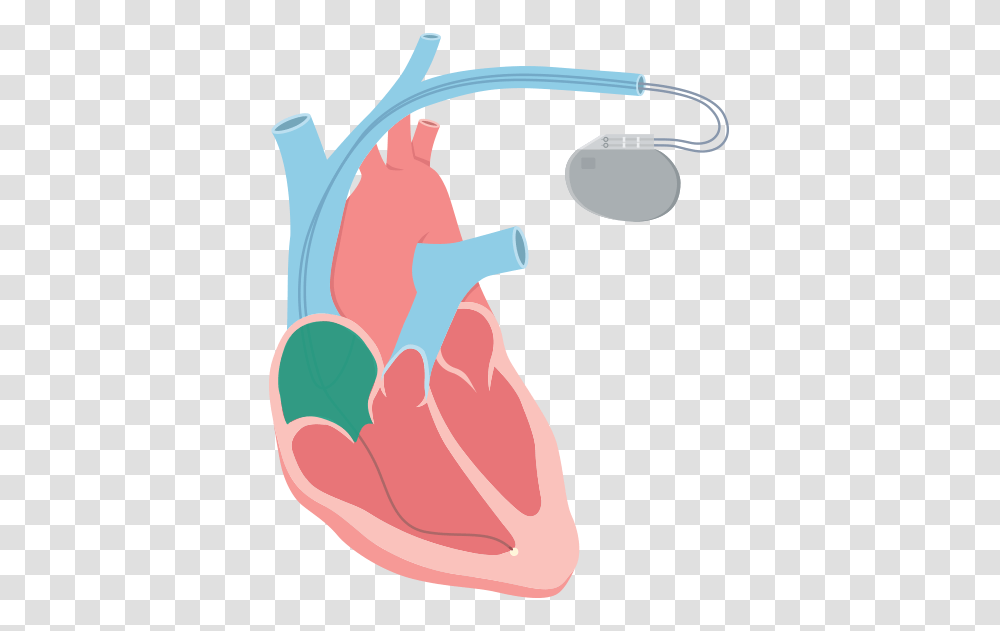 Bradycardia, Stomach Transparent Png