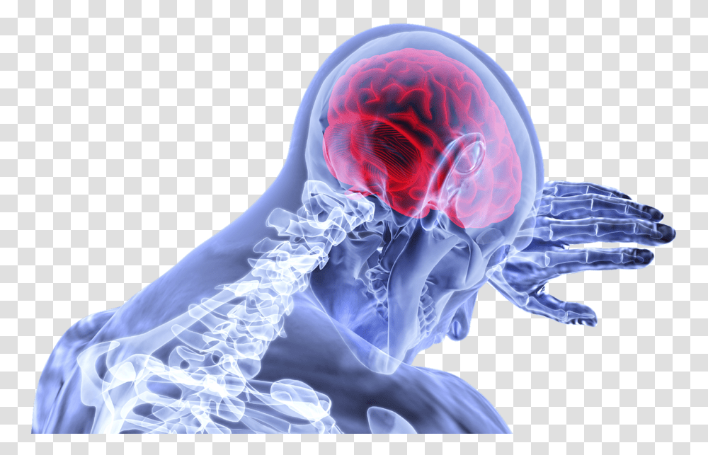 Brain 1280 Concussions, Person, Human, Animal, X-Ray Transparent Png