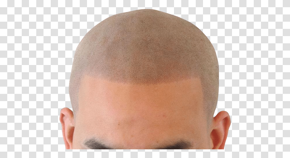 Broken Hairline Buzz Cut, Head, Face, Person, Skin Transparent Png