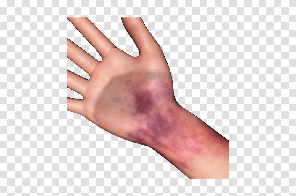 Bruise Photosymbols, Hand, Wrist, Person, Human Transparent Png