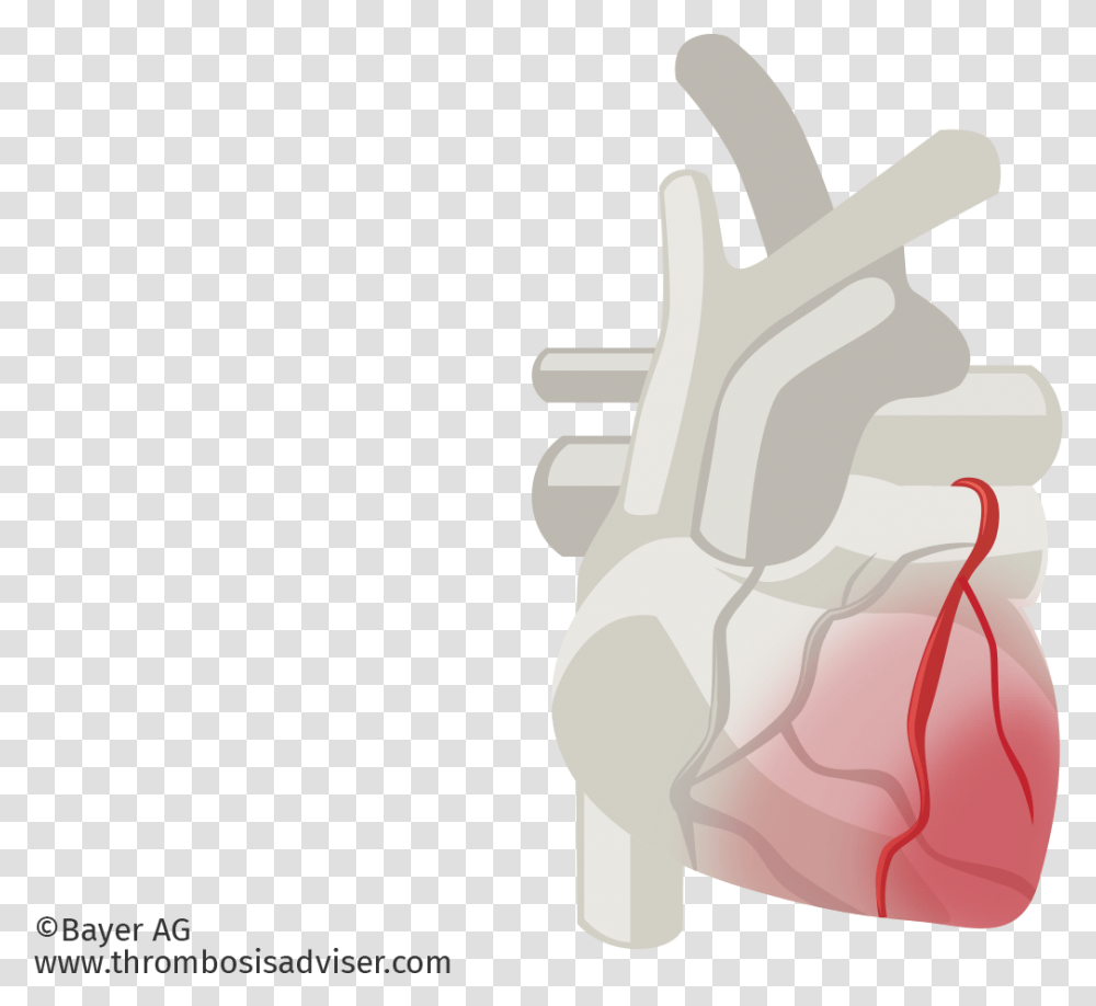 Cardiac Muscle Damage In Acs Illustration, Hand, Plot, Diagram Transparent Png