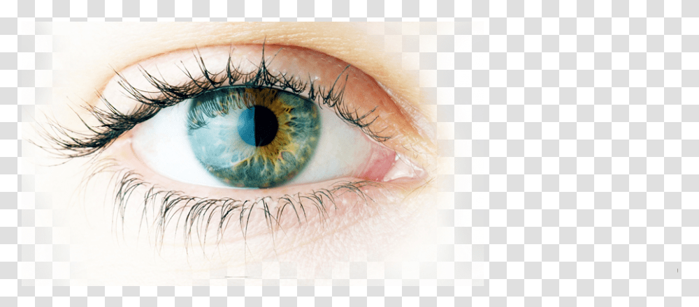 Cataract Eye Surgery In New Jersey Imagenes Sobre El Ojo, Contact Lens, Person, Human, Photography Transparent Png