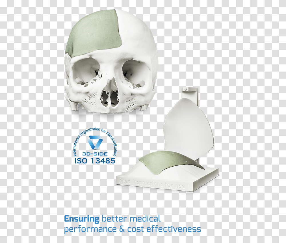 Cement Cranial Implant Skull, X-Ray, Ct Scan, Medical Imaging X-Ray Film Transparent Png