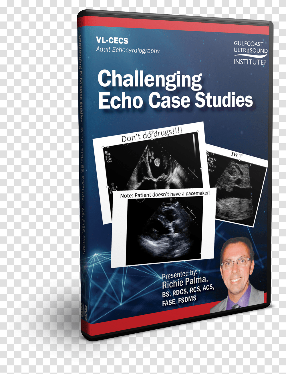 Challenging Echo Case Studies Novel, Flyer, Poster, Paper, Advertisement Transparent Png