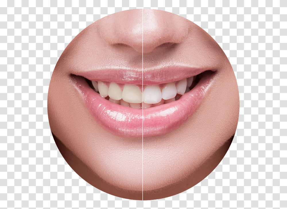 Charcoal Blast Teeth Whitening Powder Reviews, Mouth, Lip, Person, Human Transparent Png