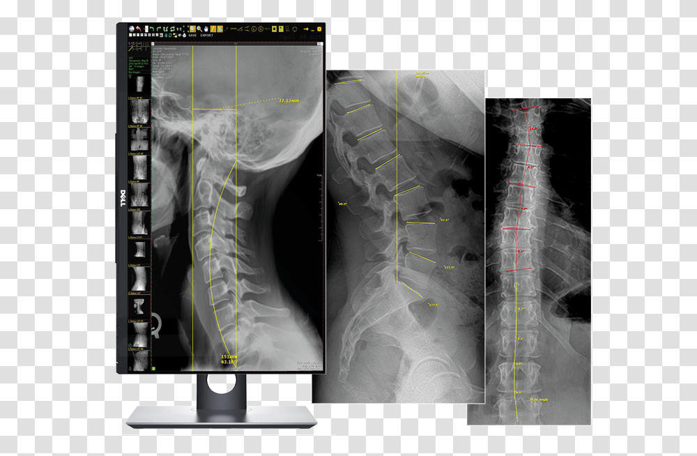 Chiropractic X Ray Machines, X-Ray, Ct Scan, Medical Imaging X-Ray Film Transparent Png