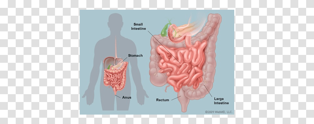 Cholera In The Small Intestine, Person, Human, Stomach, Heart Transparent Png