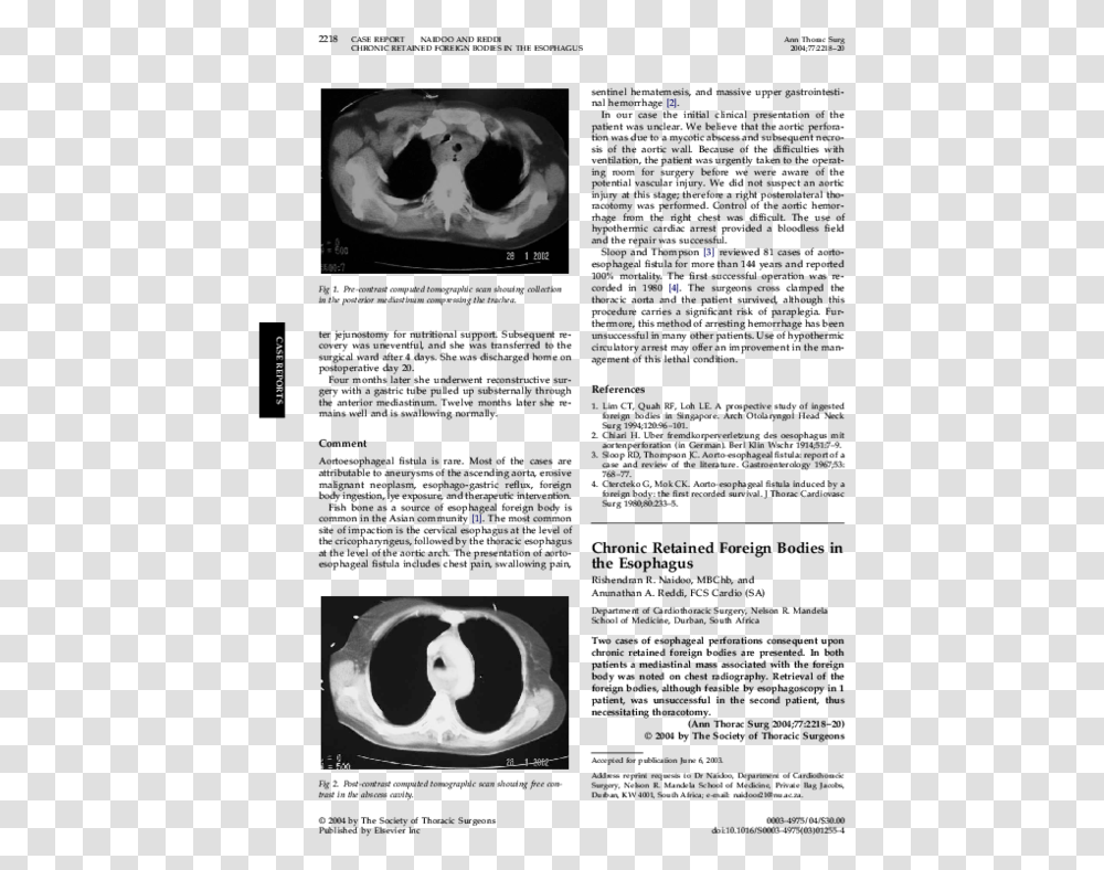 Circle, X-Ray, Medical Imaging X-Ray Film, Ct Scan, Cat Transparent Png