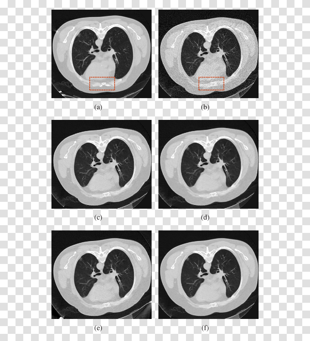 Circle, X-Ray, Medical Imaging X-Ray Film, Ct Scan, Cat Transparent Png