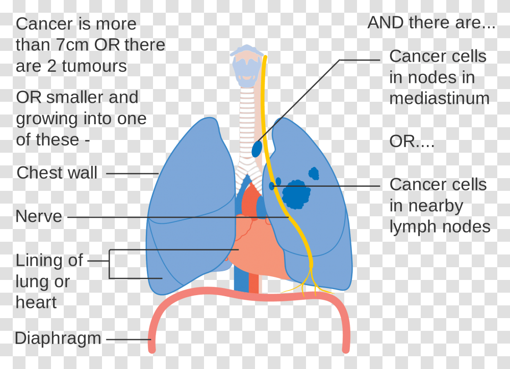 Clip Art Pictures Of Lung Cancer, Plot, Diagram, Astronomy, Outer Space Transparent Png