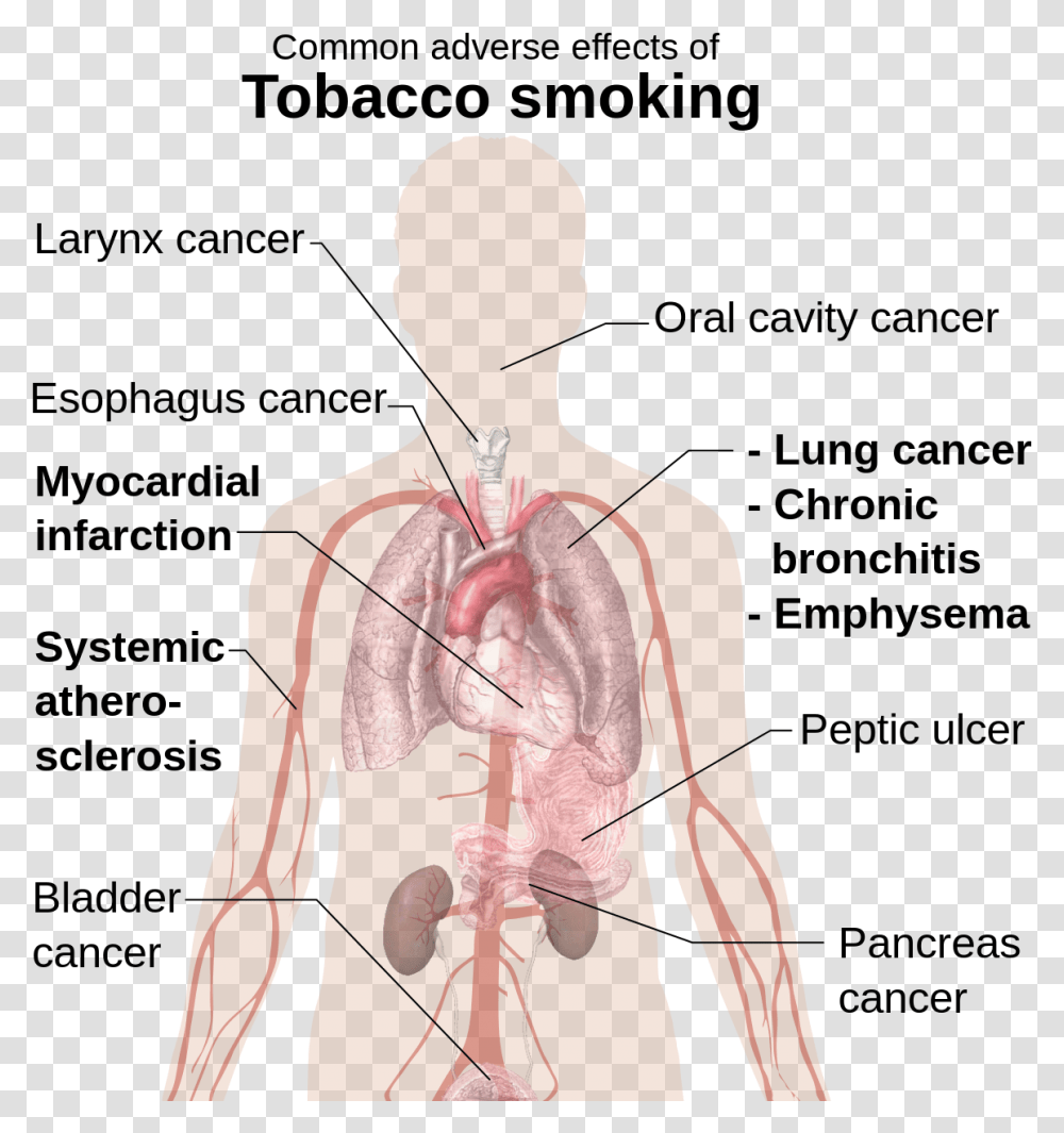 Common Adverse Effects Of Tobacco Smoking, Stomach, Person, Human, Plot Transparent Png