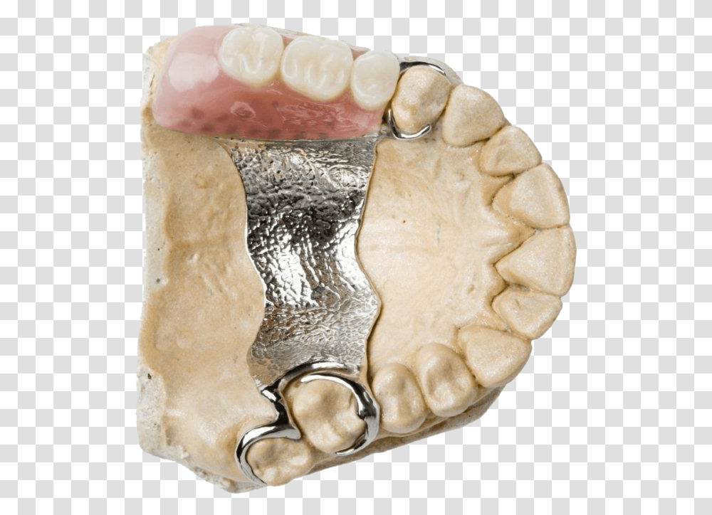 Complete Amp Partial Dentures Dentures Upper Cobalt Chrome Denture, Jaw, Teeth, Mouth, Lip Transparent Png