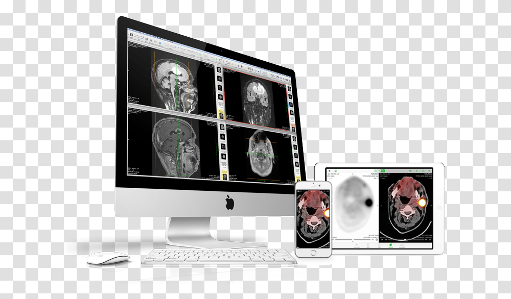 Computed Tomography, Electronics, Computer, Monitor, Screen Transparent Png