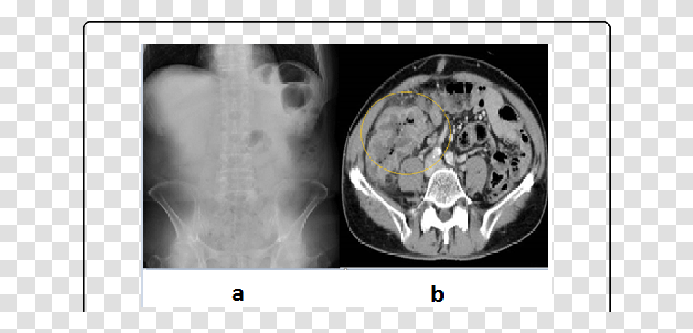 Computed Tomography, X-Ray, Medical Imaging X-Ray Film, Ct Scan, Person Transparent Png