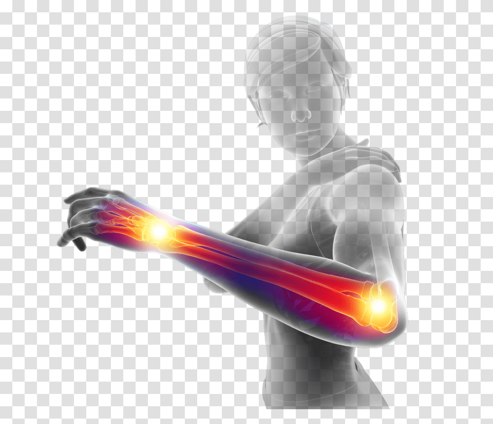 Computer Image Of Woman Looking At Inflamed Elbow Statue, Person, Helmet, Hand, Sport Transparent Png