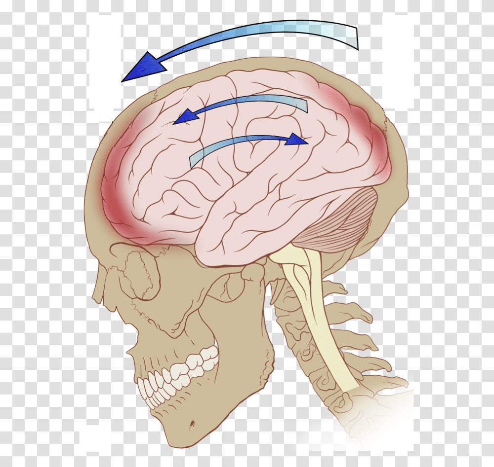 Concussion Whiplash Amp Migraine Related Injuries Primary Brain Injury, Neck, Ear, Painting Transparent Png