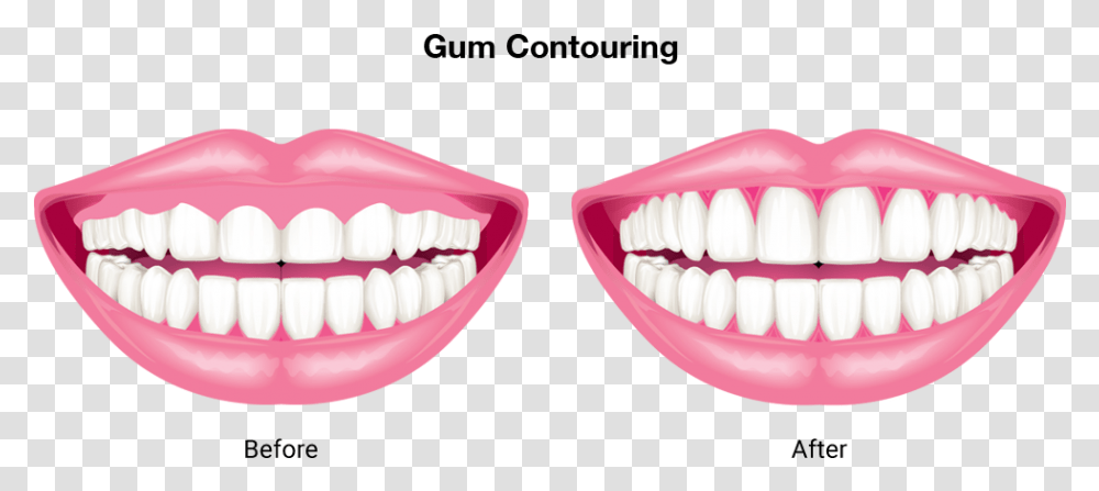 Contoured Teeth, Mouth, Lip, Pill, Medication Transparent Png