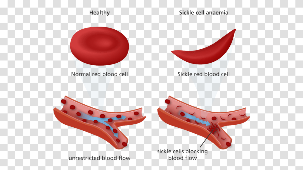 Cotton Clipart White Blood Cell Red Blood Cell Sickle Cell Transparent Png