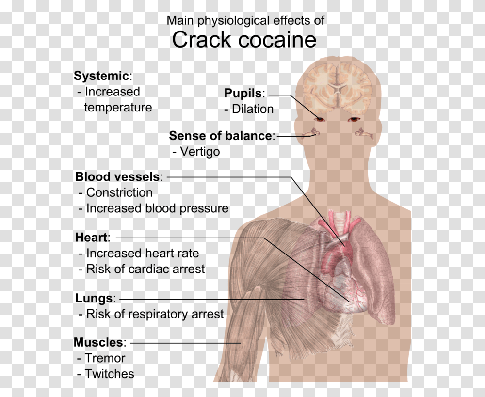 Crack Effects On Body, Neck, Shoulder, Person, Human Transparent Png
