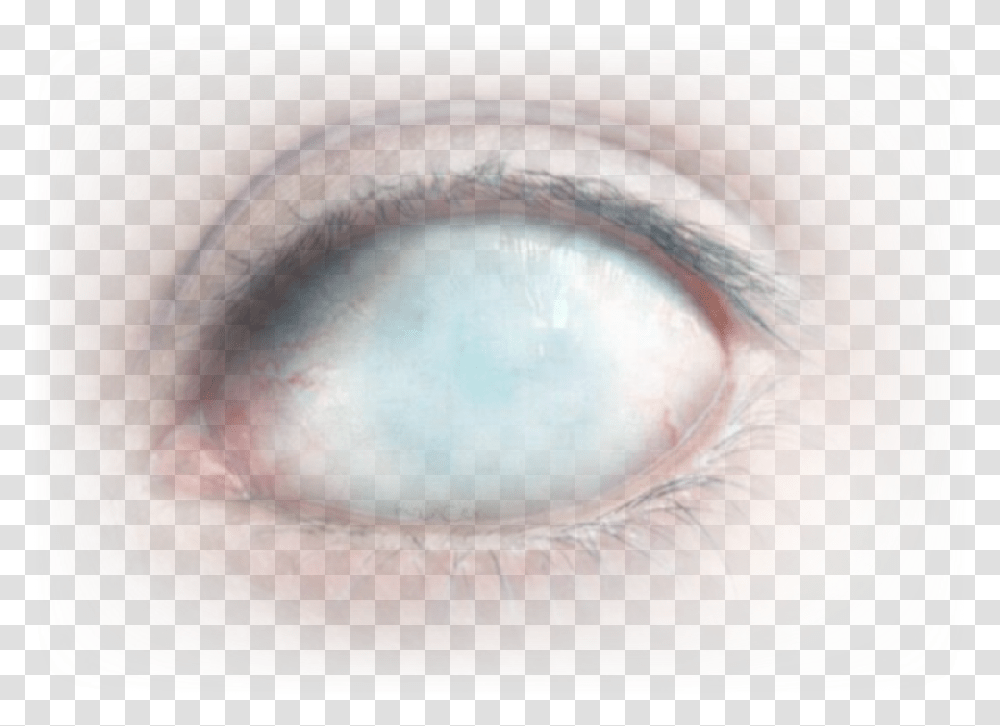 Creepy Eye, Skin, Contact Lens, Injury, Person Transparent Png