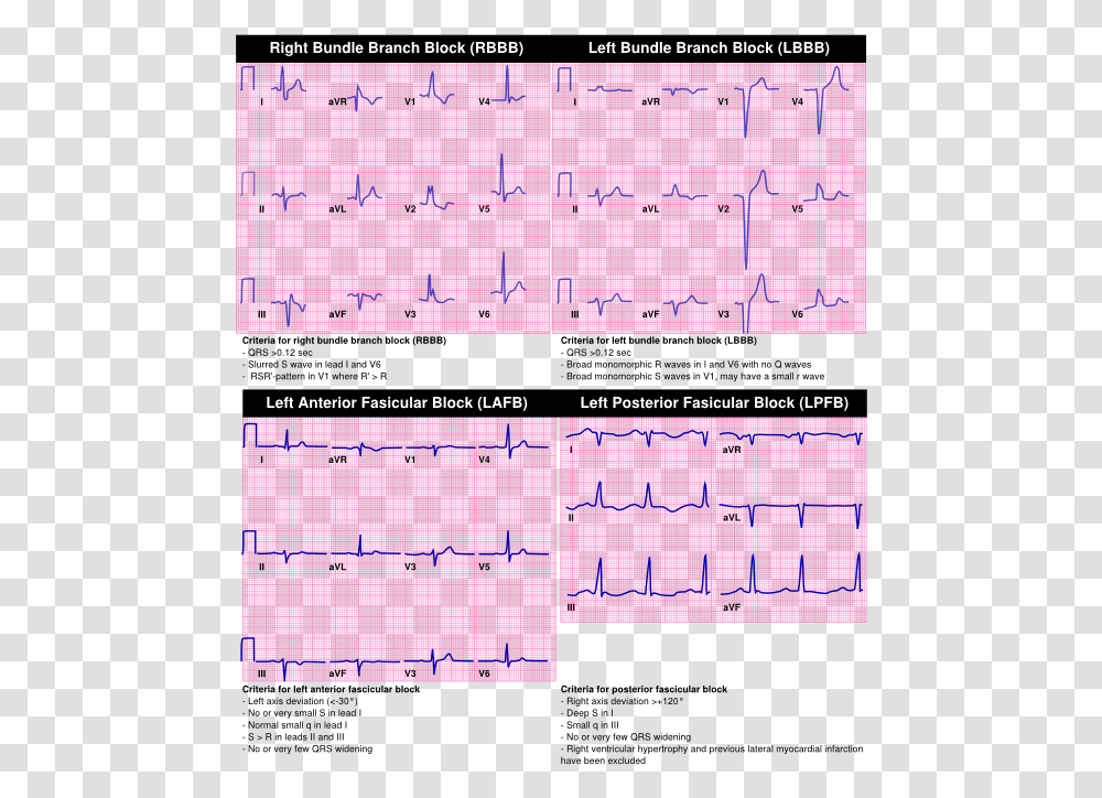 Criteria For Lbbb Rbbb Lafb Lpfb 42nd Street Photo, Word, Number Transparent Png