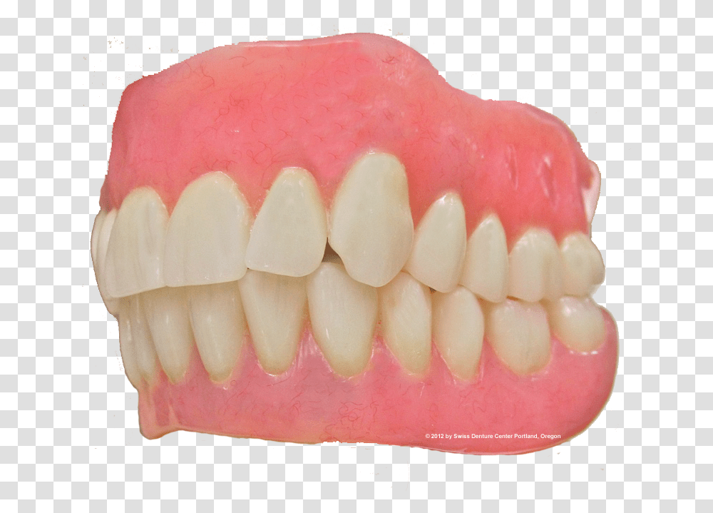 Custom Made Denture Tongue, Jaw, Teeth, Mouth, Lip Transparent Png