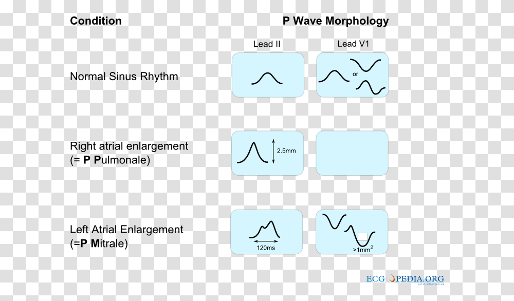 De P Wave Morphology, Number, Electronics Transparent Png