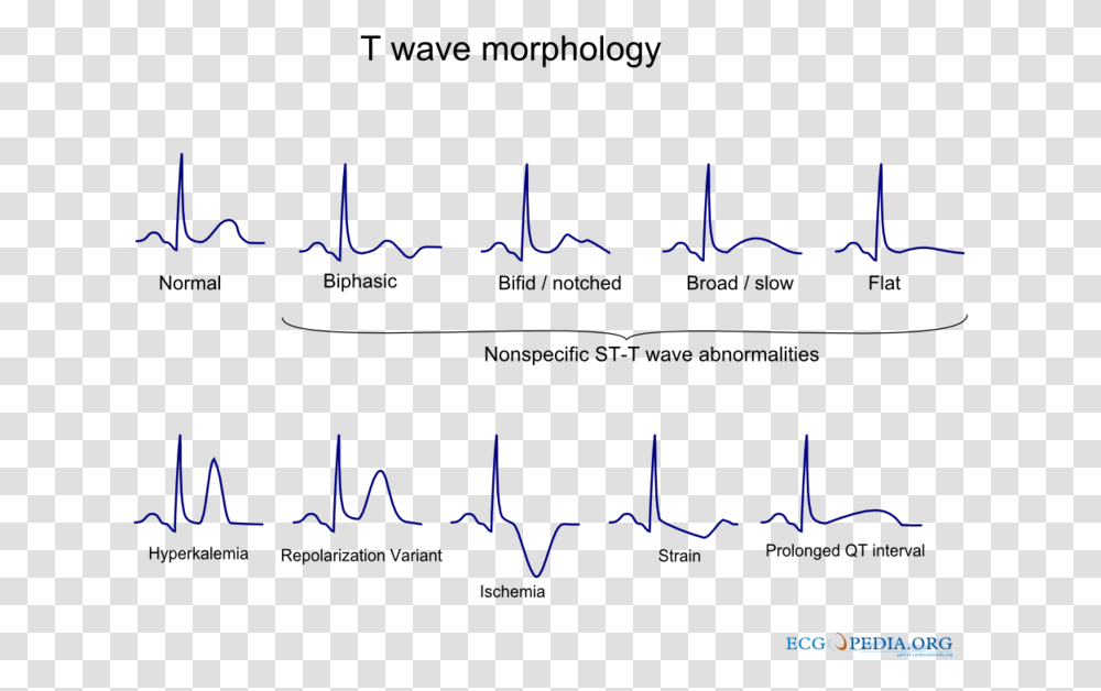 De T Wave Morphology T Wave Morphology, Alphabet, Handwriting, Outdoors Transparent Png