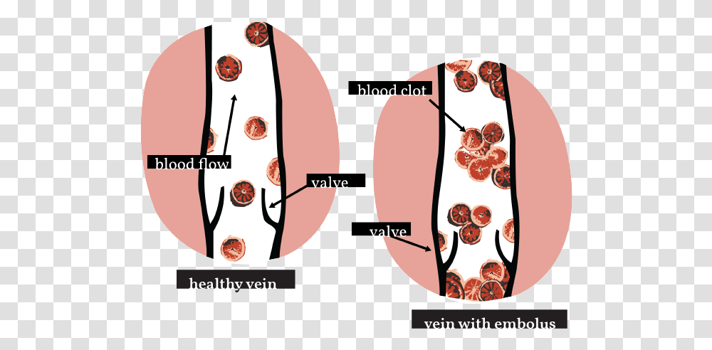 Deep Vein Thrombosis - Womanly Magazine Circle, Plot, Diagram, Mouth, Food Transparent Png