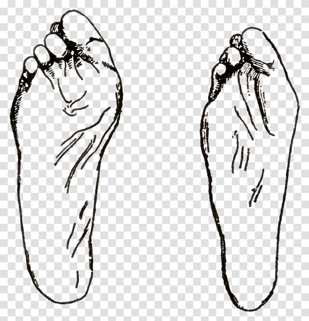 Deformities Of Feet Resulting From Bad Shoes, Apparel, X-Ray, Ct Scan Transparent Png