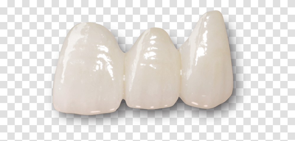 Dental Bridges Preston Layered Zirconia Crown, Teeth, Mouth, Lip, Jaw Transparent Png
