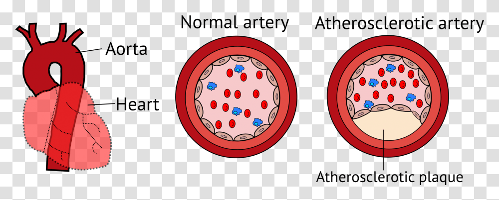 Dental Plaque Itinerary Blood Vessels Unraveling The Circle, Bowl, Text, Graphics, Art Transparent Png