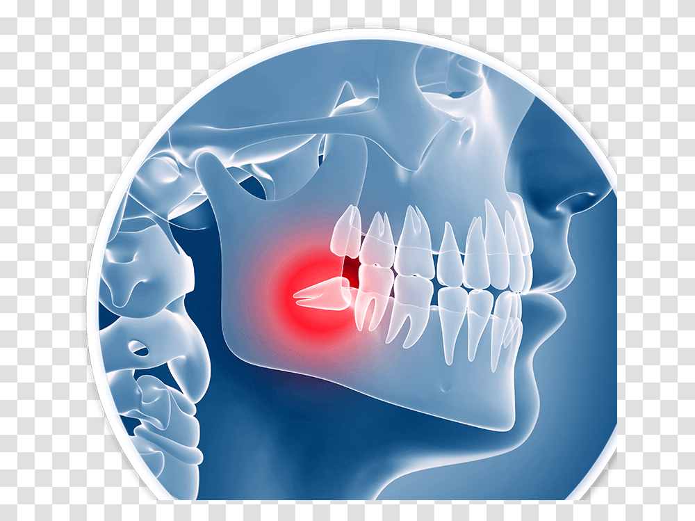 Dental Problems, Jaw, X-Ray, Ct Scan, Medical Imaging X-Ray Film Transparent Png